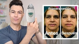 GALVÁNICA FACIAL PARA LO MEJOR PARA LAS BOLSAS DE LOS OJOS Y LAS ARRUGAS [upl. by Xavier]