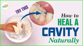 How to Get Rid of Cavities Heal and Reverse [upl. by Elsworth]