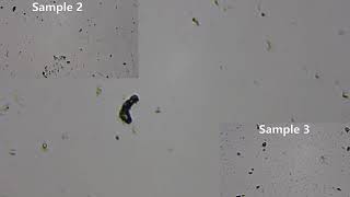 Microscopic Water Sample [upl. by Arza]