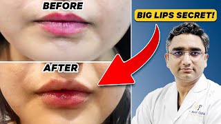 Bigger Better Beautiful Lips  Lip Transformation [upl. by Akoyin995]