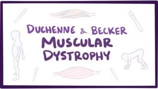 Duchenne amp Becker muscular dystrophy  causes symptoms treatment amp pathology [upl. by Nazario]