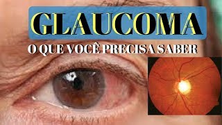 GLAUCOMA o que é e quais os seus sintomas  Dr André Wambier [upl. by Alohs]