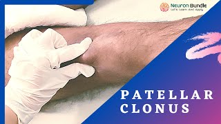 Patellar Clonus ReflexTest sustained Positive Medschool uppermotorneuron neurology [upl. by Gilmer]