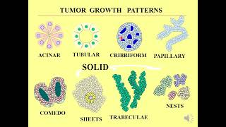 Salivary Gland Diseases and Neoplasms [upl. by Lavina]