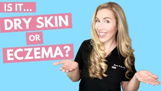 Is it Dry Skin or Eczema  How to Treat With Affordable Product Recommendations [upl. by Delwyn783]