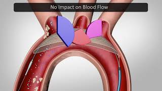 Keystone Heart [upl. by Jurgen]