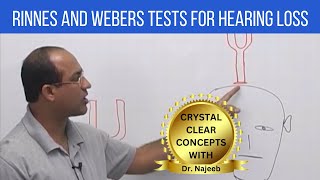 Rinnes and Webers Tests for Hearing Loss  ENT [upl. by Dirtsa]