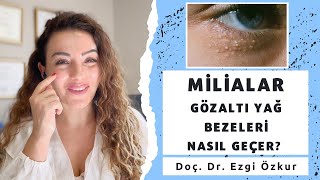 Milialar Nedir  Göz Altı Yağ Bezeleri  Yağ Kistleri Çözümü [upl. by Kelli]