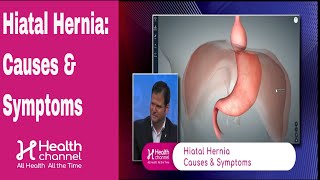 Hiatal Hernia Causes amp Symptoms [upl. by Hsirrap]