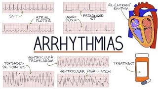 Hospital Training  Internal medicine  Arrhythmias Dr Mohammed Mahdi 20242025 [upl. by Rutledge]