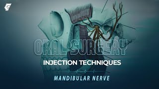 injection techniques 1 mandibular nerve  oral surgery  عزت شومان [upl. by Jackqueline]