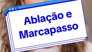 Ablação e marcapasso para tratamento das arritmias  quais as diferenças e aplicações [upl. by Nodnyl805]