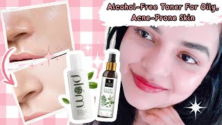 quotThe Best AlcoholFree Face Toner for Oily AcneProne Skin  All Skin Typesquot  Beauty Tips Buzz [upl. by Gneh]