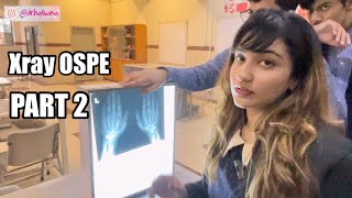 Radiology Xray OSPE Upper limb Thorax Lower Limb Anatomy Spotting PART 2 [upl. by Eimile]