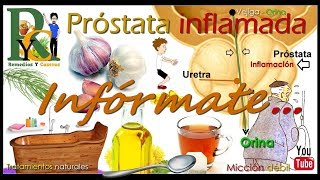 Remedios naturales para la próstata Remedios caseros para la prostatitis Próstata inflamada [upl. by Eirac]