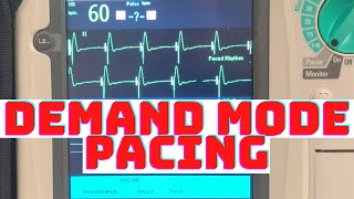 How to Properly Initiate Demand Mode TCP Transcutaneous Cardiac Pacing Why is it Safer over Fixed [upl. by Aisile]