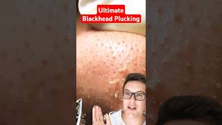 Crazy Satisfying BLACKHEAD PLUCKING  You Will Love This shorts [upl. by Airol]