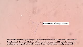 Germination of Fungal Spores Demonstration [upl. by Eicnan96]