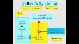 Gilberts syndrome by labpedianet Prof Riaz A Bhutta Urdu Hindi [upl. by Rolf]