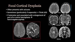 imaging Congenital malformation Brain and spine [upl. by Keever]