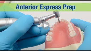 Anterior Express Prep [upl. by Bricker]