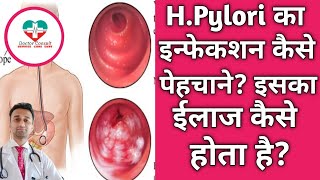 HPylori Details। HPylori का इन्फेकशन कैसे पेहचाने इसका ईलाज क्या है [upl. by Hirai612]