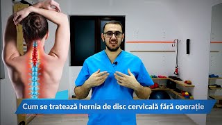 Cum poți trata hernia de disc cervicală fără operație kinetoterapie cervicală [upl. by Maillliw]