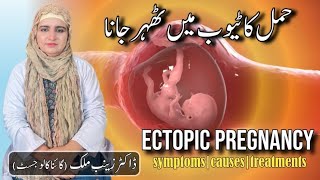 What is Ectopic pregnancy  Risk factorssymptoms and Treatment of Ectopic Pregnancy by Dr Zainab [upl. by Scutt746]