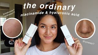 the ordinary niacinamide and hyaluronic acid 1 MONTH review with BEFOREAFTER [upl. by Corin]