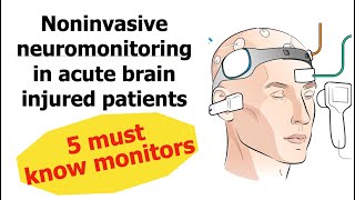 5 Noninvasive neuromonitoring in Neuro ICU That you must know [upl. by Wandis]