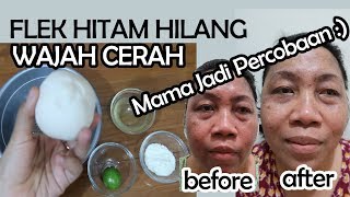 Masker alami untuk menghilangkan flek hitam dengan Bengkoang Review Velrose Secret [upl. by Sremlahc]