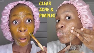 🔥Watch⚠️ before USING TURMERIC amp SUGAR on FACEJalia Walda [upl. by Wolfgang]