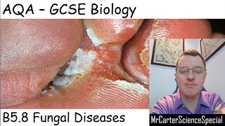 B58  Fungal Diseases  AQA Biology GCSE 91 [upl. by Nednyl]