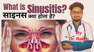 sinusitis treatment sinusitis kya haisinusitis ki symptoms sinusitis ki hoi sinusitis ki ilaj [upl. by Nrol92]