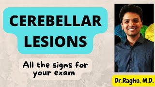 Cerebellar disorder  Signs of cerebellar dysfunction  Neurology  Cerebellar lesion [upl. by Selimah]