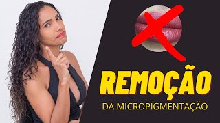 COMO REMOVER UMA MICROPIGMENTAÇÃO LABIAL [upl. by Skcirdnek]