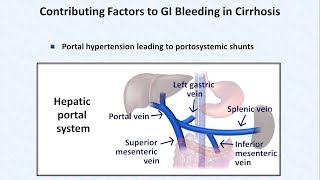 Esophageal Varices and Variceal Hemorrhage [upl. by Yehudi437]