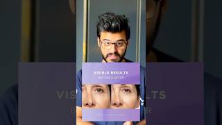 Best Face Whitening Cream for Wrinkles foryou foryoupageofficial reels viralvideo shorts [upl. by Terrance]