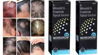 Novegrow 5 Topical Solution Minoxidil amp Finasteride Topical Solution [upl. by Anderson762]