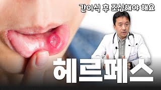 EP181 면역력 떨어지면 치명적인 바이러스 feat헤르페스CMV EBV  서울대병원 소아청소년과 윤기욱 교수 간담췌외과 김재윤 전임의 [upl. by Lenoyl]