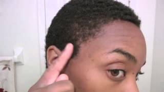 Natural Alopecia Treatment HAIR GROWTH Results  Month 2 [upl. by Reade]