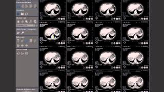 Logiciel diagnostique imagerie médicale [upl. by Norvall]