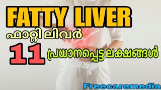 Fatty liver symptoms malayalam  liverdisease liver liverdiseasesymptoms [upl. by Michaela]