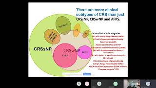 Chronic Rhinosinusitis Hamilos [upl. by Breskin874]