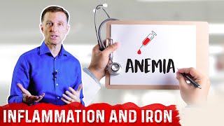 Why Chronic Inflammation Causes Anemia Iron Deficiency – Anemia of Chronic Disease – DrBerg [upl. by Favian]