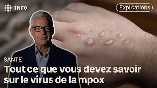 Virus mpox  c’est quoi et comment se transmetil [upl. by Zita]