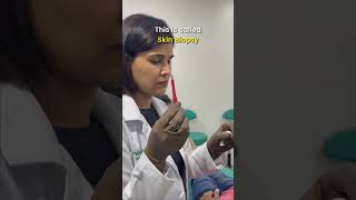 Skin Biopsy 💉🧏‍♀️ Procedure By Dermatologist  Dr Priyanka Reddy  DNA Skin Clinic  shorts [upl. by Chilcote]