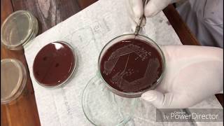 methyl red test [upl. by Asor733]