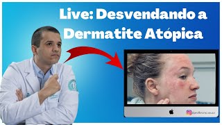 Live Dermatite Atópica  Causas Sintomas e Tratamentos com Dr Bruno Souza [upl. by Duff]