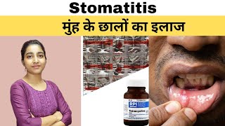 मुँह के छाले का इलाज़Lecture 15 stomatitis [upl. by Reedy]